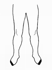 4級（両側）のイラスト