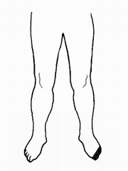 7級（片側）のイラスト